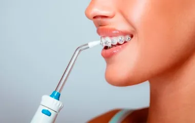 Що краще: іригатор чи зубна щітка?