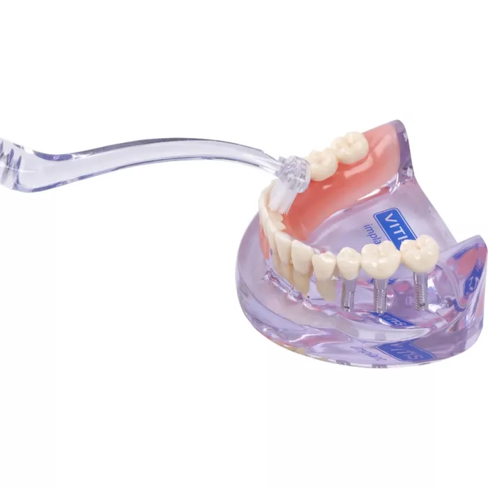 Зубна щітка VITIS IMPLANT ANGULAR для імплантів, коронок та мостів