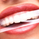 SmileKit PAP+ відбілювальні смужки для зубів, 28 шт./14 пар