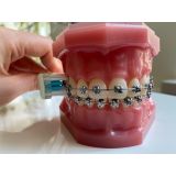 Зубна щітка Edel+White Pro Ortho, ортодонтична, ультра м'яка